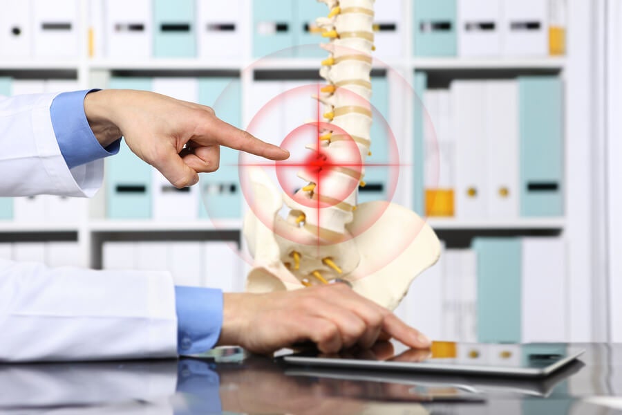 Doctor pointing out a herniated disc