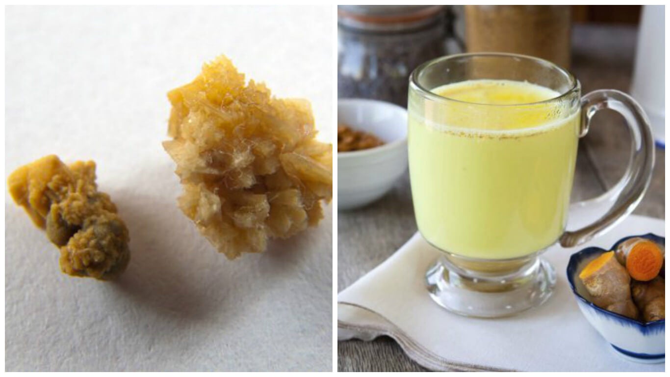 Fight kidney stones with ginger and turmeric tea