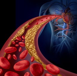 Diet model to lower triglycerides