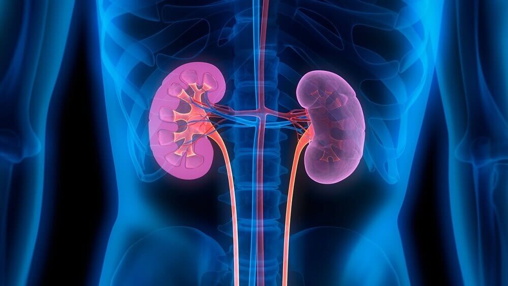 kidneys and kidney stones