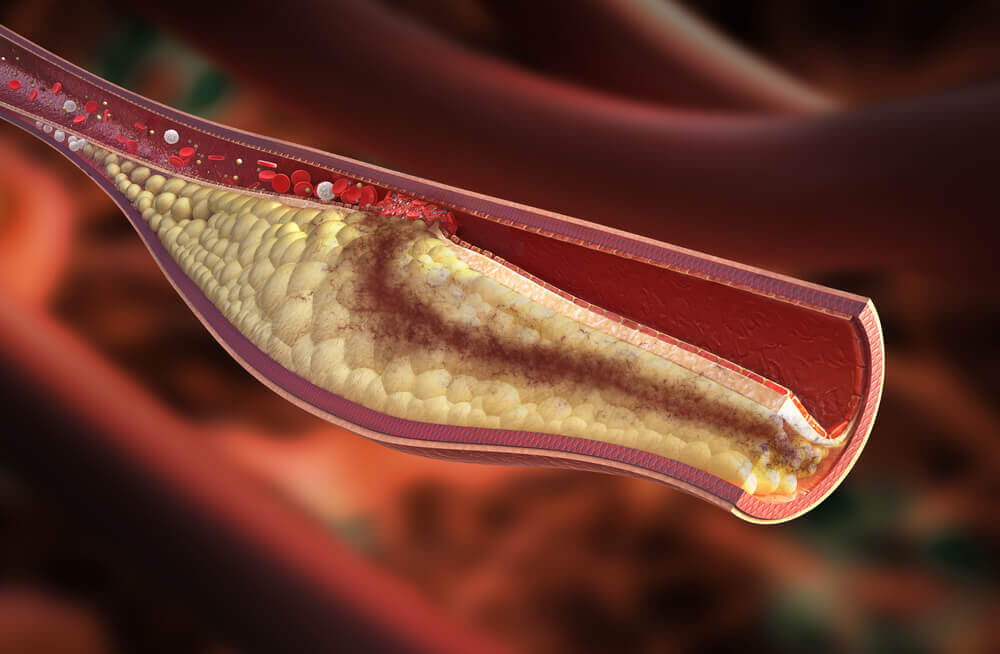 Adequate cholesterol level