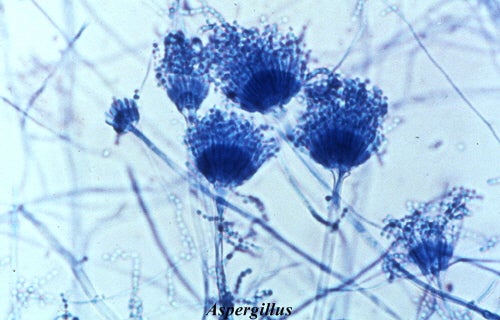 Aspergillus mold