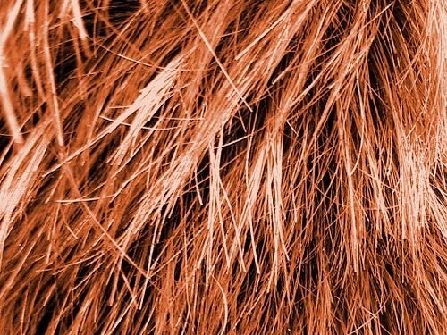 How can we get rid of dandruff?