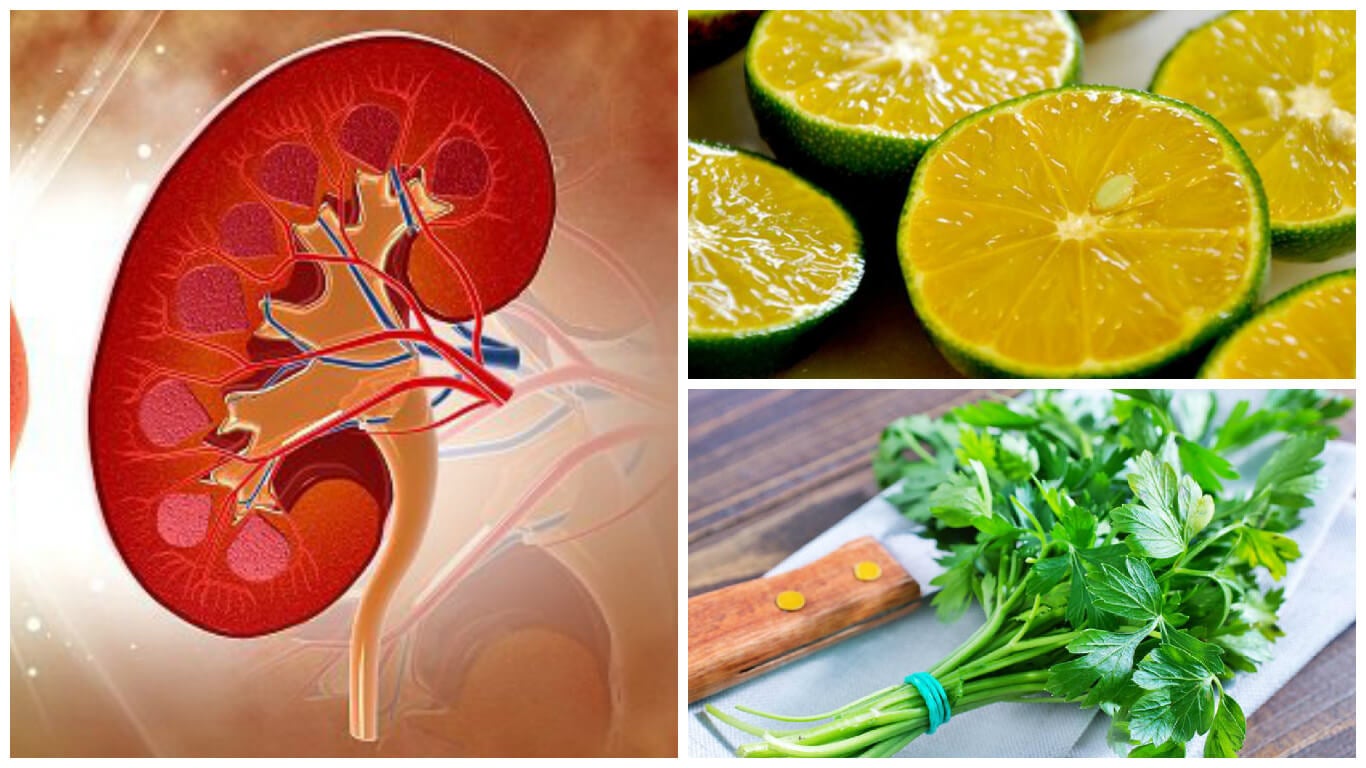 This lemon and parsley syrup will help you fight kidney stones