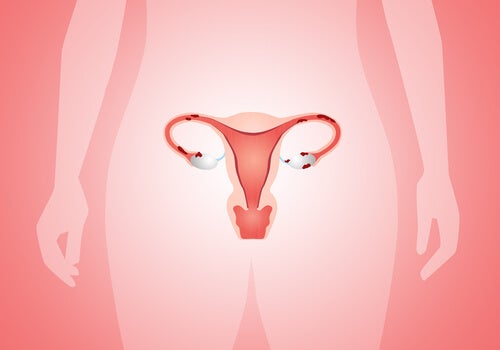 uterus with endometriosis